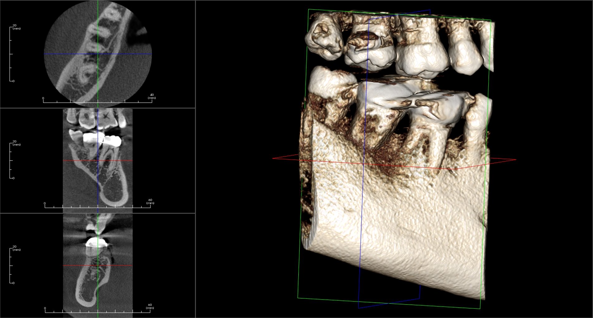 Xray animation examples